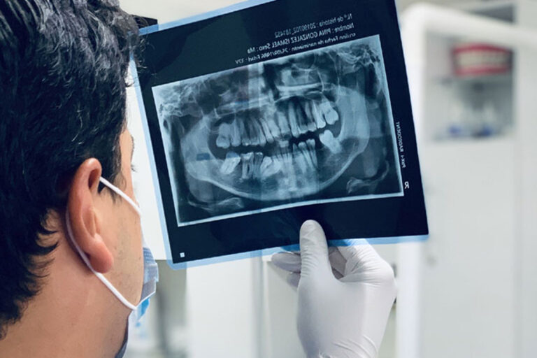 Dal-Carlo-Radiografia