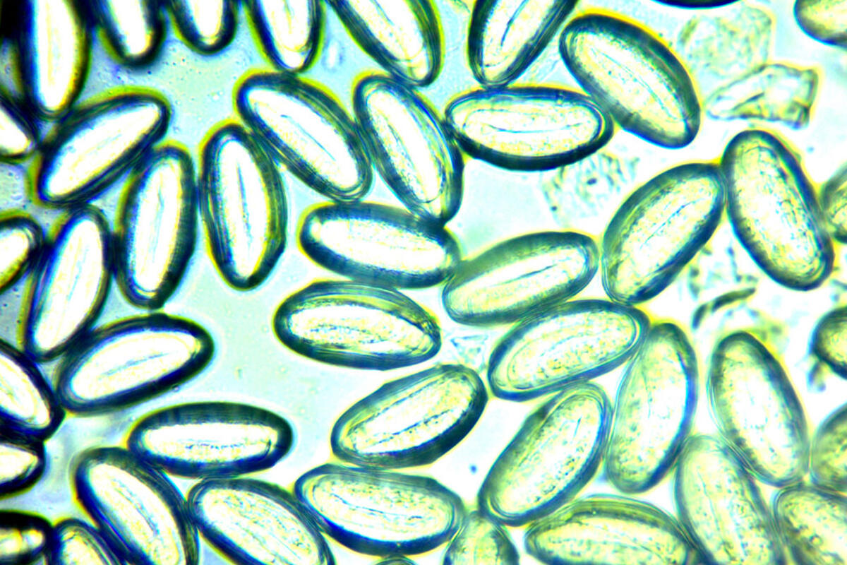 passarella-ossiluro-vermi-nei-bambini